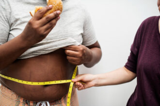 Treatment and Prevention of Obesity
